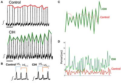 Chronic Intermittent Hypoxia Differentially Impacts Different States of Inspiratory Activity at the Level of the preBötzinger Complex